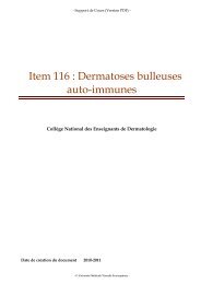 Item 116 : Dermatoses bulleuses auto-immunes