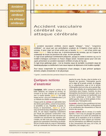 Signes de l'AVC.pdf - Accident vasculaire cérébral