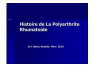 Histoire de La Polyarthrite Rhumatoide