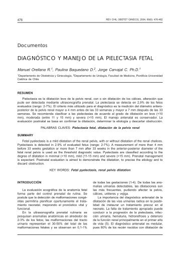 DIAGNÓSTICO Y MANEJO DE LA PIELECTASIA FETAL - SciELO