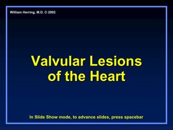 Valvular Lesions of the Heart - LearningRadiology