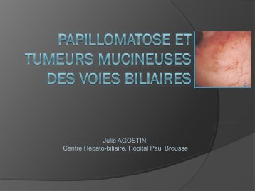 Papillomatose et tumeurs mucineuses des voies biliaires