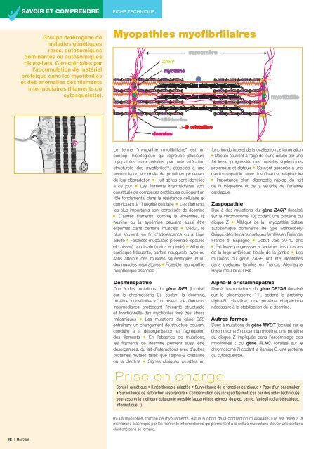 Principales maladies neuromusculaires - Institut de Myologie