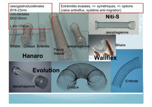 Traitement endoscopique des occlusions intestinales ... - Hepato Web