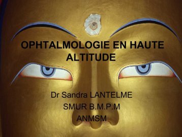 Pathologie Ophtalmique en Montagne , Dr Sandra Lantelme