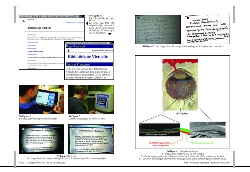 Echelle contraste variable