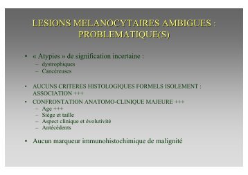 Lesions melanocytaires ambigues.pdf - AFIAP