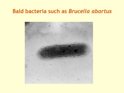 Brucella