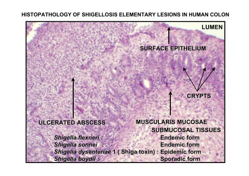 Shigella Effectors at Work - EMBO