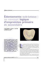 La fraise, instrument de référence dans l'évaluation visuelle de la largeur  de la limite cervicale d'une préparation périphérique – L'Information  Dentaire