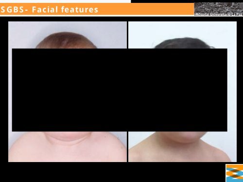 5 SGBS Facial Features 5-sgbs-facial-features
