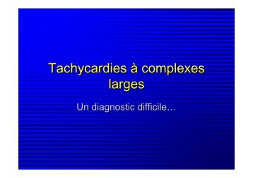 Tachycardies à complexes larges - SMUR BMPM