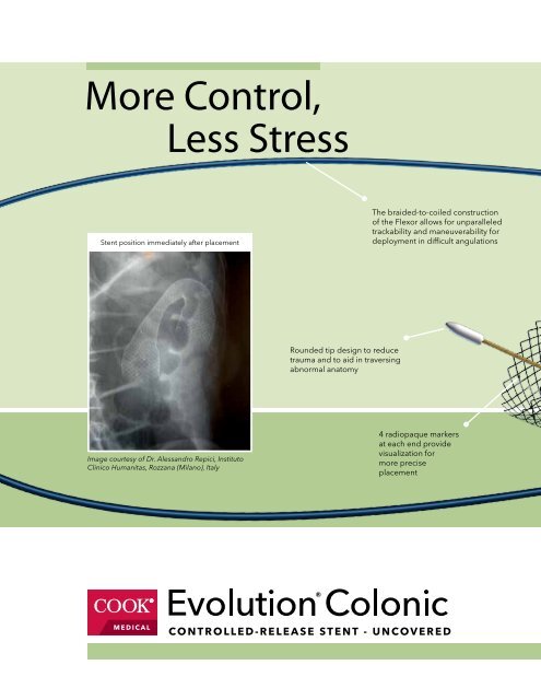 Evolution Colonic Uncovered Controlled-Release ... - Cook Medical