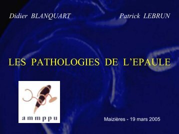 Pathologies de l'épaule - ammppu