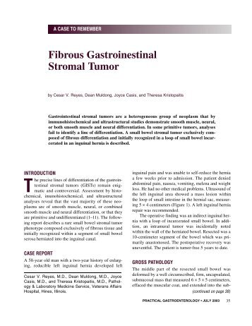 Read Full Article - Practical Gastroenterology