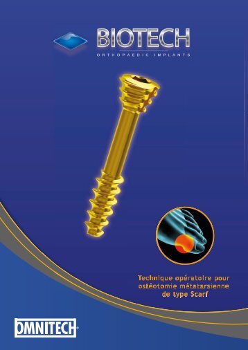 Technique opératoire pour ostéotomie métatarsienne ... - Biotech ortho
