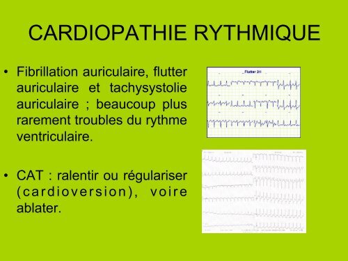 PRINCIPALES CARDIOPATHIES