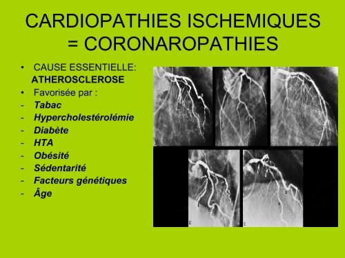 PRINCIPALES CARDIOPATHIES