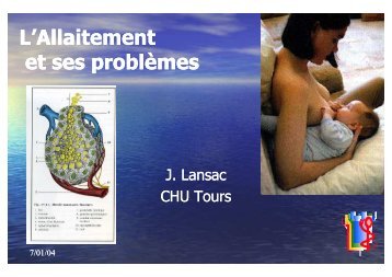 L'allaitement et ses problemes