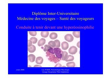 Conduite à tenir devant une hyperéosinophilie