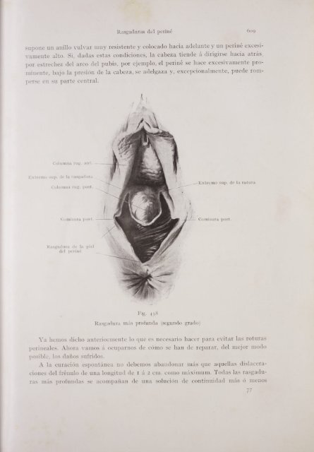 perficial (primer grado) de la piel del periné - Dipòsit Digital de la UB