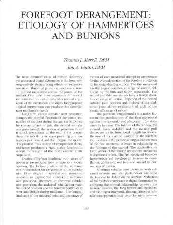 Etiology of Hammertoes and Bunions - The Podiatry Institute