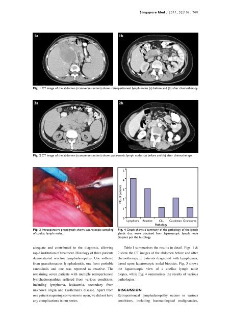 Laparoscopic retroperitoneal/mesenteric lymph ... - APAMED Central