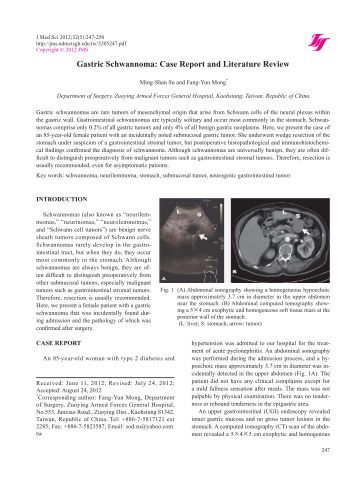 Literature review type 2 diabetes