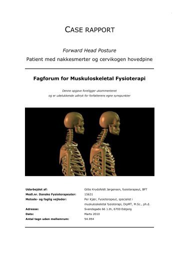 Forward Head Posture - patient med nakkesmerter og cervikogen