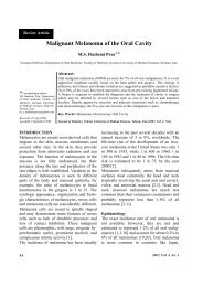 Malignant Melanoma of the Oral Cavity - TUMS Electronic Journals