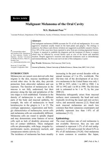 Malignant Melanoma of the Oral Cavity - TUMS Electronic Journals