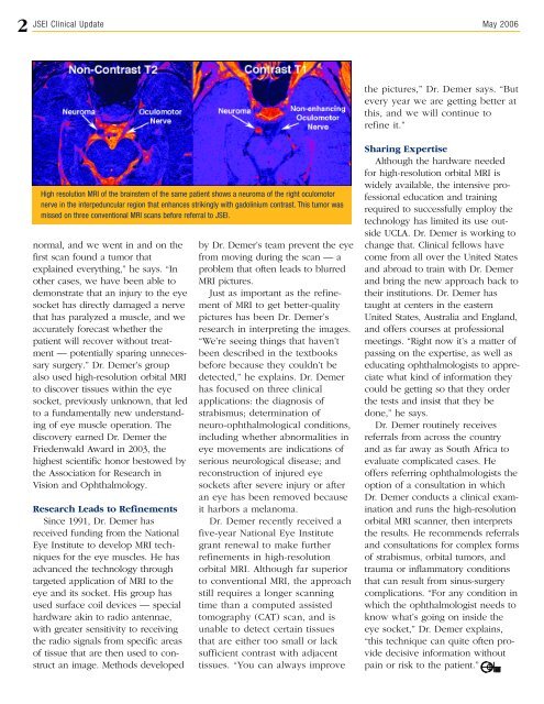 View May 2006 Clinical Update - Jules Stein Eye Institute