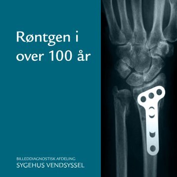 Røntgen i over 100 år - Sygehus Vendsyssel - Region Nordjylland