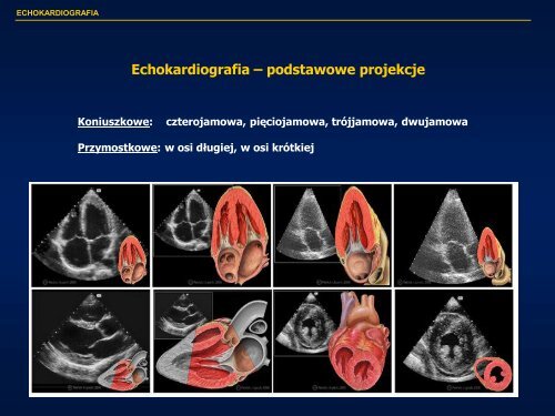 Echokardiografia w kardiologii