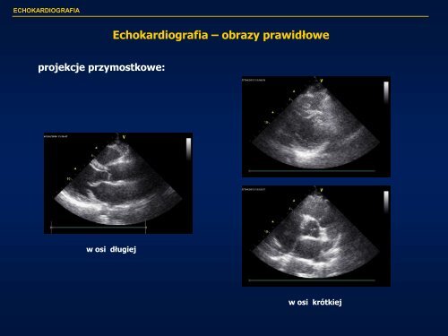 Echokardiografia w kardiologii