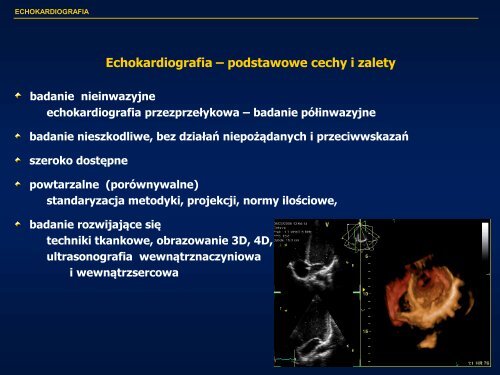 Echokardiografia w kardiologii