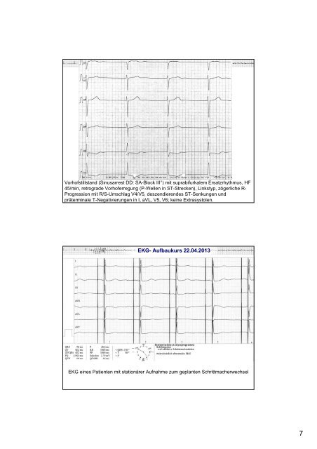 EKG - Aufbaukurs