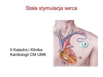 do serca