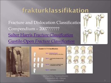 Frakturklassifikation, erfaring med systematisk klassifikation, dansk ...