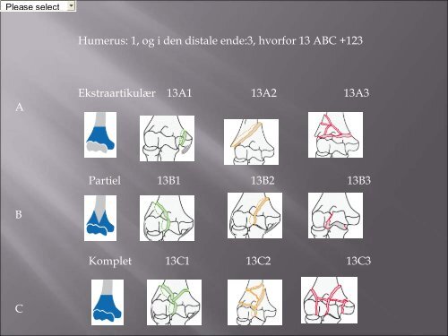 Frakturklassifikation, erfaring med systematisk klassifikation, dansk ...