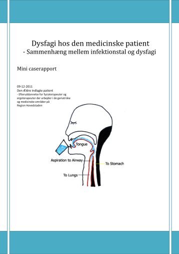 Dysfagi hos den medicinske patient - Hvidovre Hospital