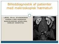 Billeddiagnostik af patienter med makroskopisk hæmaturi