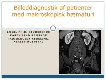 Billeddiagnostik af patienter med makroskopisk hæmaturi