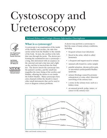 Cystoscopy and Ureteroscopy - National Kidney and Urologic ...