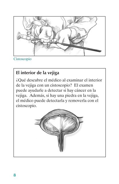 síndrome de vejiga dolorosa - National Kidney and Urologic ...