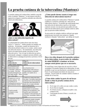 The TB Skin Test (Mantoux) – Spanish - Public Health