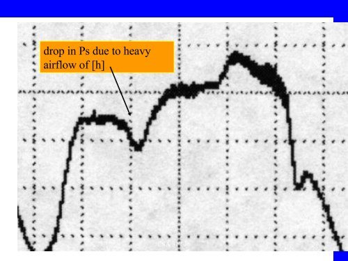 Plethysmograph - Linguistics