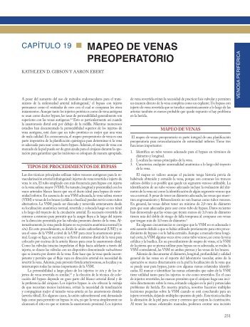 MAPEO DE VENAS PREOPERATORIO - Axon