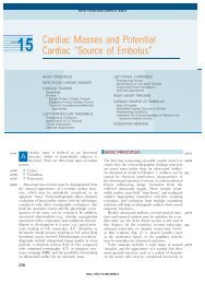 Cardiac Masses and Potential Cardiac ?Source of Embolus? - Axon