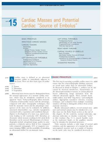 Cardiac Masses and Potential Cardiac ?Source of Embolus? - Axon